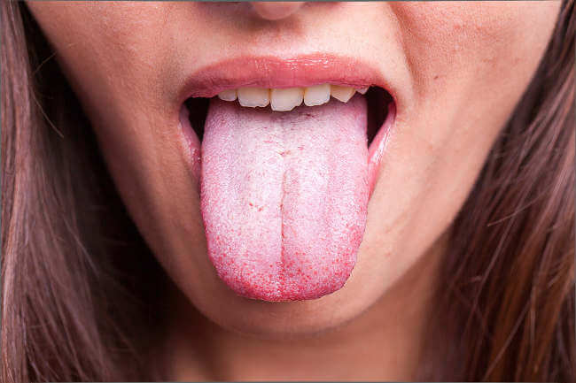 Welche Krankheiten verrät uns unsere Zunge? - Hogmag
