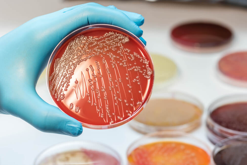 Escherichia coli: alles, was Sie wissen müssen 