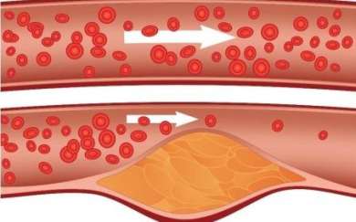 7 Mythen, die Sie über Cholesterin wissen sollten  