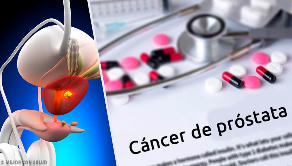 Dieta radioterapia cáncer próstata